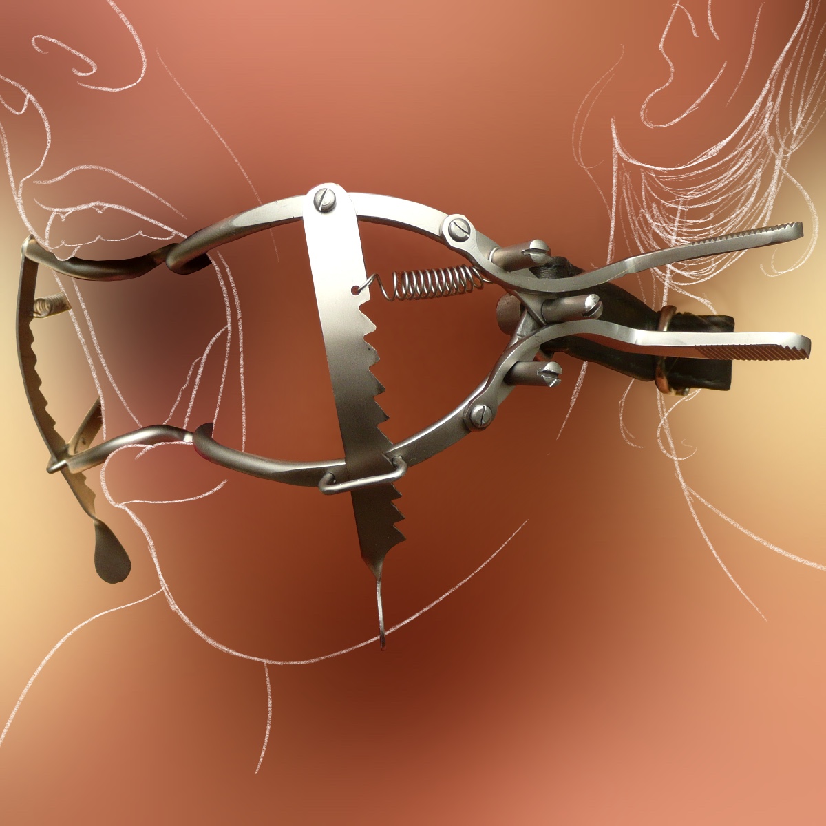 Mundspreizer nach Whitehead, seidenmatt