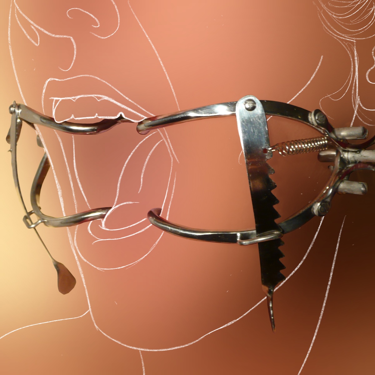 Mundspreizer nach Whitehead, hochglänzend